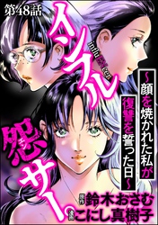 インフル怨サー。 ～顔を焼かれた私が復讐を誓った日～（分冊版）　【第48話】