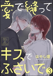 愛で縫ってキスでふさいで（分冊版）　【第3話】
